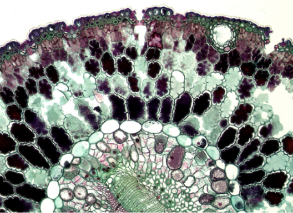 Can stem cells help Arthritis?