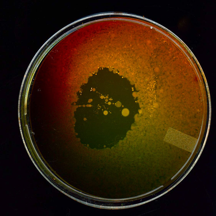 Bacterial culture plate with visible colonies on a dark background