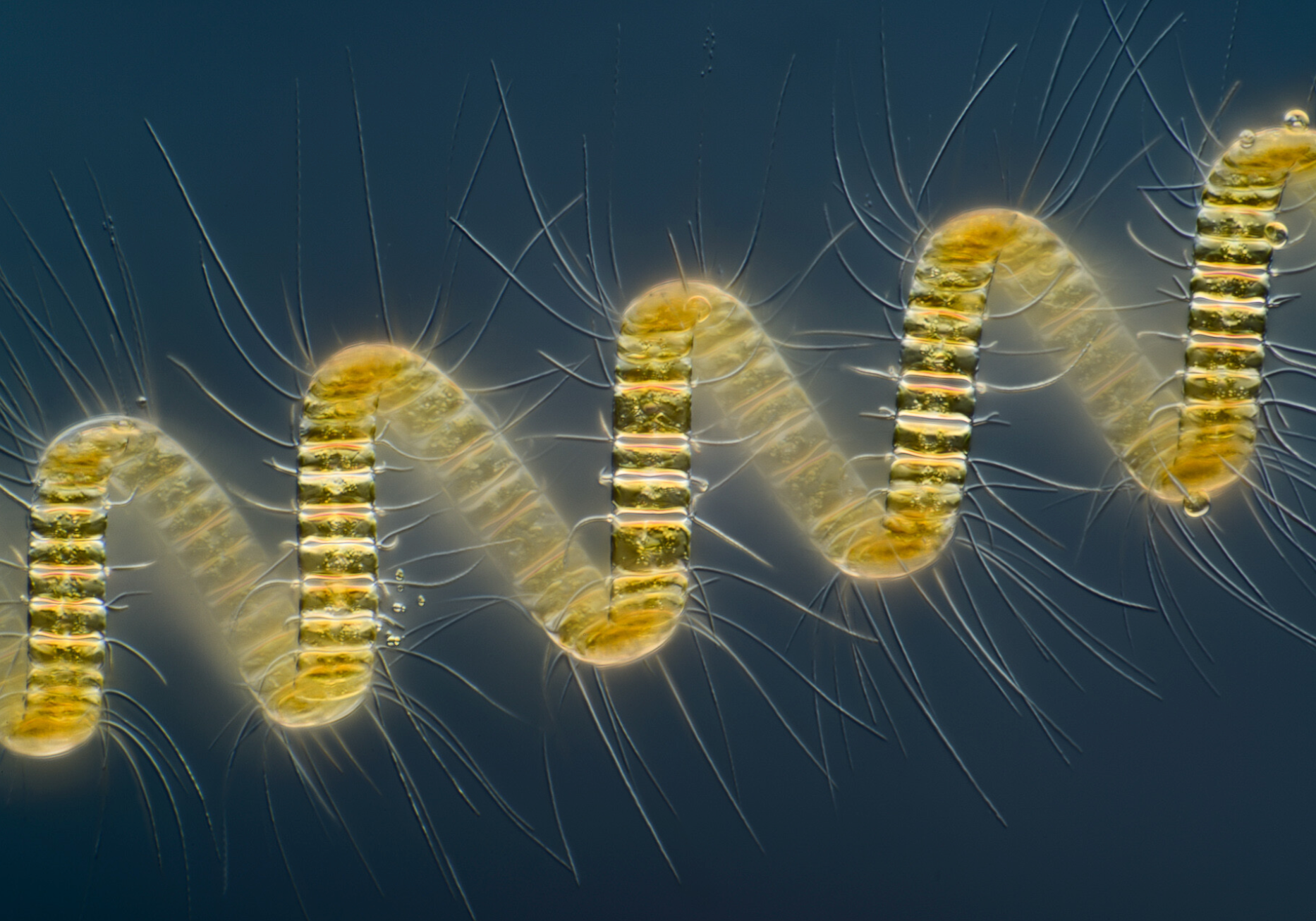 Microscopic view of a yellow microorganism, highlighting its unique structure and features in close detail.