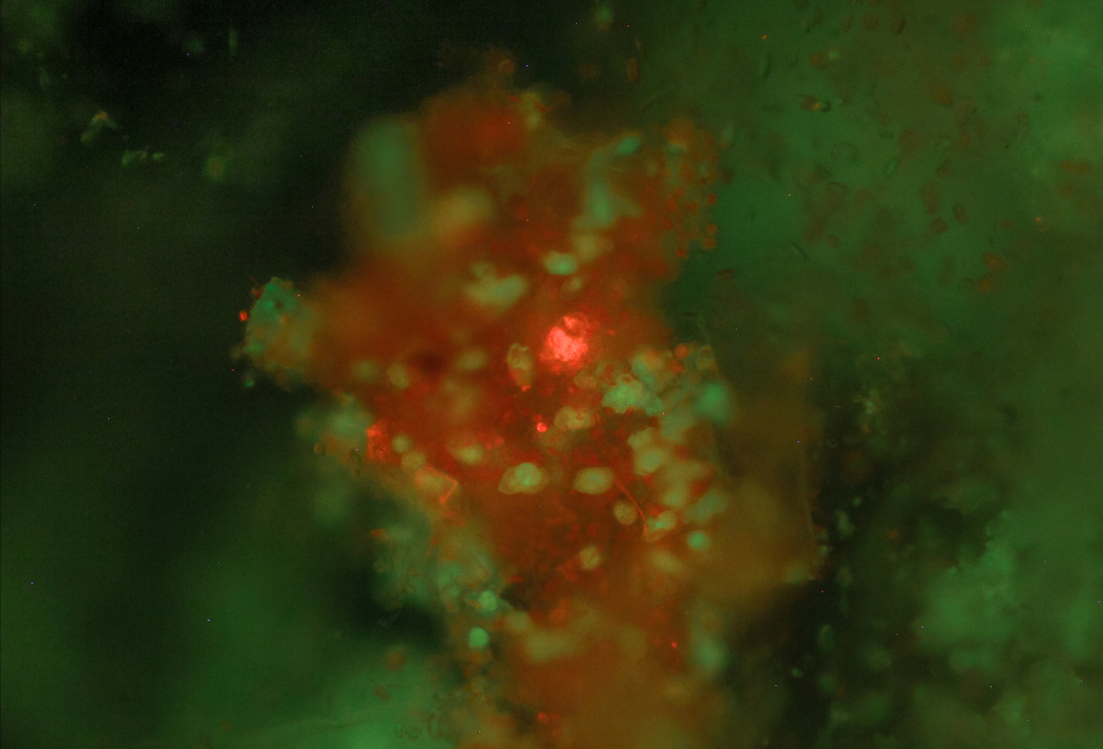 A close up of green and red microorganisms.