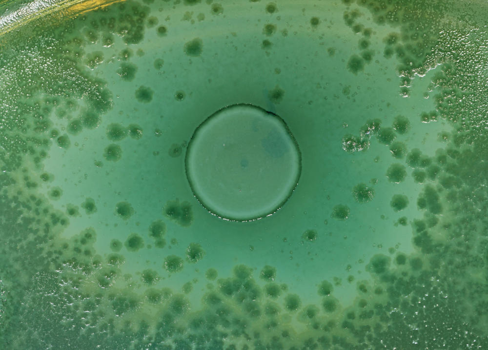 A microscopic image containing a green microorganism with visible bubbles floating on top.